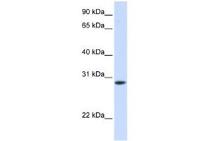 WB Suggested Anti-TNNT3 Antibody Titration:  0. (TNNT3 anticorps  (C-Term))