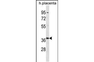 Western blot analysis in human placenta tissue lysates (35ug/lane). (PSMD6 anticorps  (AA 154-182))