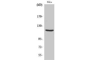 Western Blotting (WB) image for anti-PR (Thr229) antibody (ABIN3176998) (PR (Thr229) anticorps)