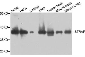 Western blot analysis of extracts of various cell lines, using STRAP antibody. (STRAP anticorps)