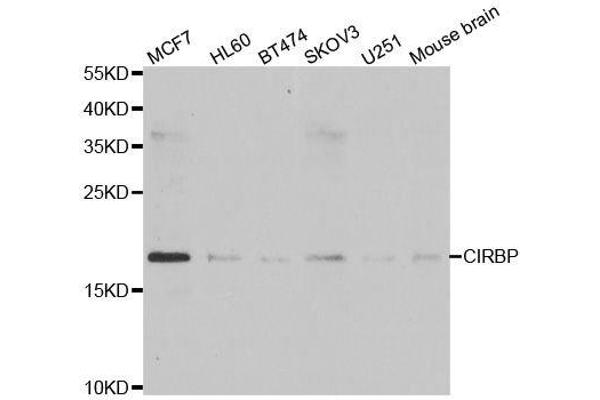 CIRBP anticorps  (AA 1-172)