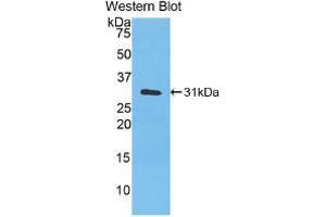 Western blot analysis of recombinant Human CA3. (CA3 anticorps  (AA 2-260))