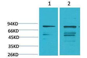 Western Blotting (WB) image for anti-Phosphoinositide 3 Kinase, p85 alpha (PI3K p85a) antibody (ABIN3179081) (PIK3R1 anticorps)