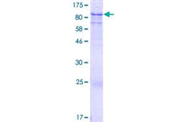 ACSS3 Protein (AA 1-686) (GST tag)