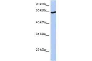 Western Blotting (WB) image for anti-Insulin-Like Growth Factor 2 mRNA Binding Protein 1 (IGF2BP1) antibody (ABIN2462219) (IGF2BP1 anticorps)