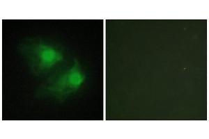 Immunofluorescence (IF) image for anti-LIM Domain Kinase 2 (LIMK2) (Internal Region) antibody (ABIN1849457) (LIMK2 anticorps  (Internal Region))