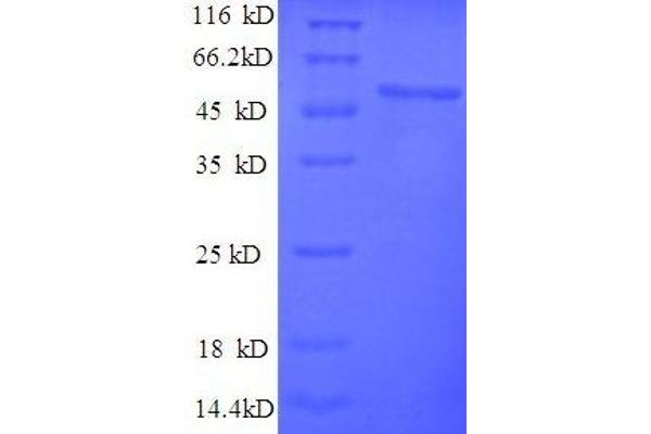 RPL15 Protein (AA 2-204, full length) (GST tag)