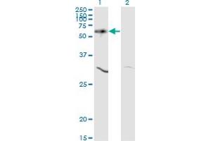 Western Blotting (WB) image for anti-V-Akt Murine Thymoma Viral Oncogene Homolog 1 (AKT1) (AA 1-481) antibody (ABIN598531) (AKT1 anticorps  (AA 1-481))