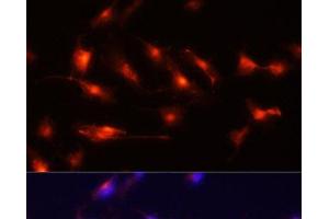 Immunofluorescence analysis of U-251MG cells using Nestin Polyclonal Antibody at dilution of 1:100 (20x lens). (Nestin anticorps)