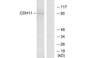 Western Blotting (WB) image for anti-Cadherin 11 (CDH11) (Internal Region) antibody (ABIN1850215) (OB Cadherin anticorps  (Internal Region))