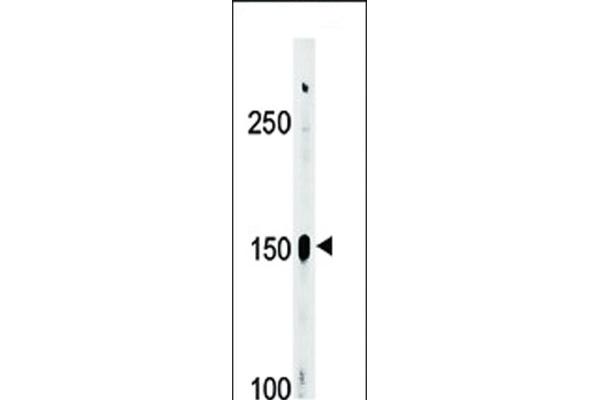 ABL2 anticorps  (pTyr393, pTyr439)