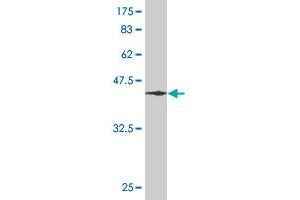 Western Blot detection against Immunogen (46. (RHOA anticorps  (AA 1-193))