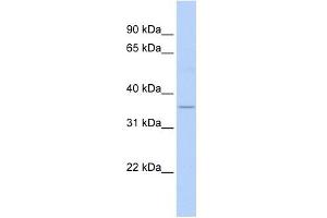 ELOVL5 antibody used at 1 ug/ml to detect target protein. (ELOVL5 anticorps)