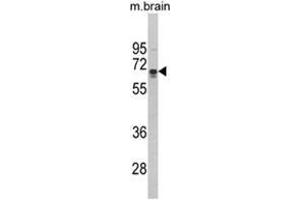 Western blot analysis of ZMYND11 Antibody (N-term) in mouse brain tissue lysates (35ug/lane). (ZMYND11 anticorps  (N-Term))