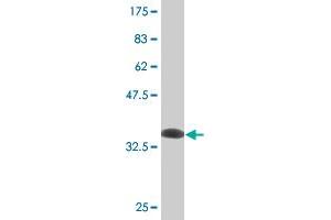 Western Blot detection against Immunogen (35. (RING1 anticorps  (AA 81-170))