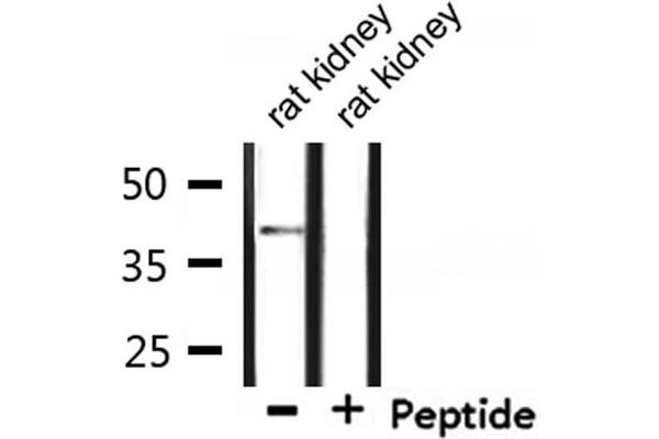 CCRL1 anticorps  (C-Term)