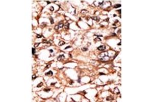 Image no. 1 for anti-Tumor Necrosis Factor Receptor Superfamily, Member 1A (TNFRSF1A) (pSer274) antibody (ABIN358242) (TNFRSF1A anticorps  (pSer274))