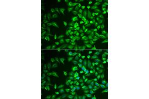 Immunofluorescence analysis of U2OS cells using LRAT antibody. (LRAT anticorps)