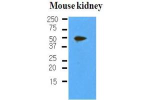 Western Blotting (WB) image for anti-Podoplanin (PDPN) antibody (ABIN306460) (Podoplanin anticorps)