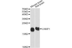 Western blot analysis of extracts of various cell lines, using VAMP1 antibody (ABIN5995694) at 1/1000 dilution. (VAMP1 anticorps)
