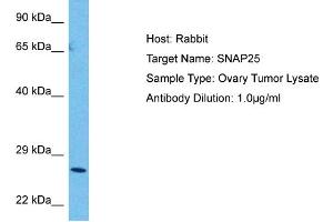 Host:  Rabbit  Target Name:  SNAP25  Sample Tissue:  Human Ovary Tumor  Antibody Dilution:  1ug/ml (SNAP25 anticorps  (C-Term))