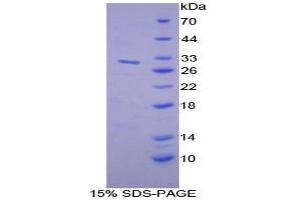 SDS-PAGE analysis of Mouse MUSK Protein. (MUSK Protéine)