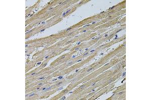 Immunohistochemistry of paraffin-embedded rat heart using EIF4A2 antibody (ABIN5972034) at dilution of 1/100 (40x lens). (EIF4A2 anticorps)
