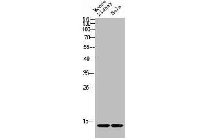 Western blot analysis of Mouse-kidney HELA lysis using Acetyl-Histone H4 (K12) antibody. (HIST1H4A anticorps  (acLys12))