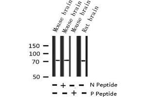 Western blot analysis of Phospho-LIMK1/2 (Thr508/505) expression in various lysates (LIMK-1/2 (pThr505), (pThr508) anticorps)