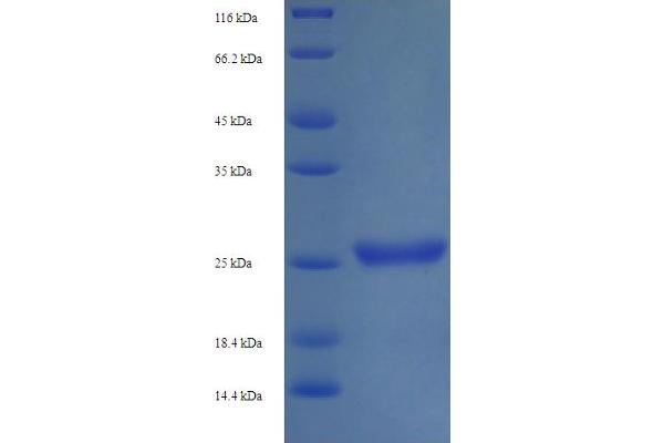 KIR2DS1 Protein (AA 22-245) (His tag)