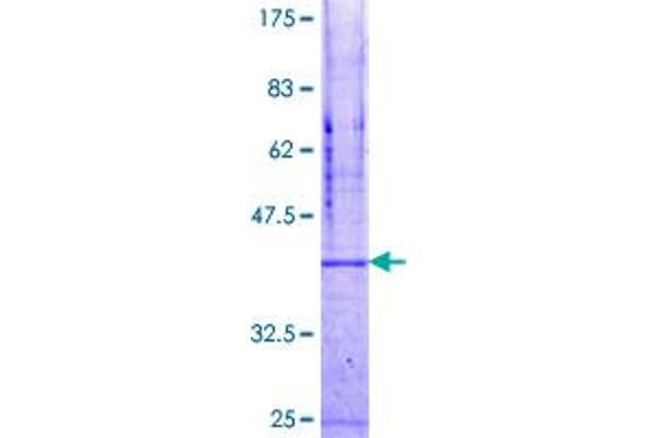 NET1 Protein (AA 443-542) (GST tag)