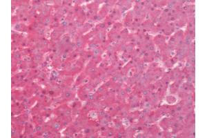 Human Liver: Formalin Fixed, Paraffin Embedded (FFPE) (Transferrin anticorps)