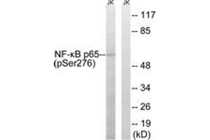 Western Blotting (WB) image for anti-Nuclear Factor-kB p65 (NFkBP65) (pSer276) antibody (ABIN2888487) (NF-kB p65 anticorps  (pSer276))