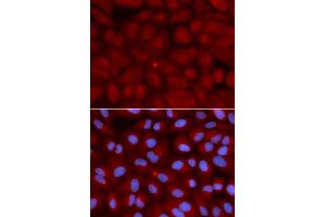 Immunofluorescence analysis of U2OS cells using BIN1 antibody. (BIN1 anticorps)