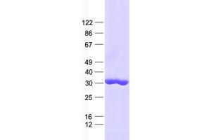 Validation with Western Blot (RGS18 Protein (His tag))