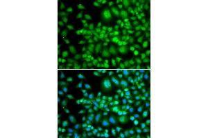 Immunofluorescence analysis of MCF-7 cells using SETD5 antibody (ABIN5974406). (SETD5 anticorps)