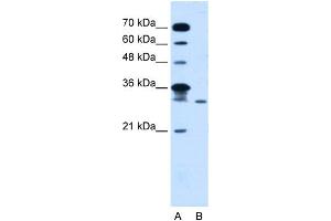 WB Suggested Anti-GLTPD2 Antibody Titration:  5. (GLTPD2 anticorps  (Middle Region))