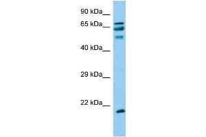 Host: Rabbit Target Name: ANKRD60 Sample Type: Fetal Liver lysates Antibody Dilution: 1. (ANKRD60 anticorps  (C-Term))