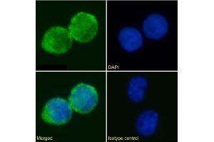 Immunofluorescence staining of Jurkat cells using anti-IL2R antibody AHT107. (Recombinant CD25 anticorps)