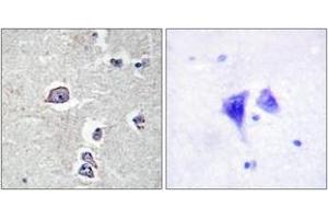 Immunohistochemistry (IHC) image for anti-Platelet Derived Growth Factor Receptor alpha (PDGFRA) (AA 721-770) antibody (ABIN2888854) (PDGFRA anticorps  (AA 721-770))