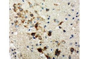 IHC-P: TSC1 antibody testing of rat brain tissue (TSC1 anticorps  (C-Term))