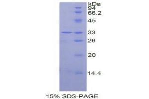 SDS-PAGE analysis of Human MAPK14 Protein. (MAPK14 Protéine)