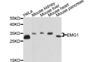 Western blot analysis of extracts of various cell lines, using EMG1 antibody (ABIN5972482) at 1/1000 dilution. (EMG1 anticorps)