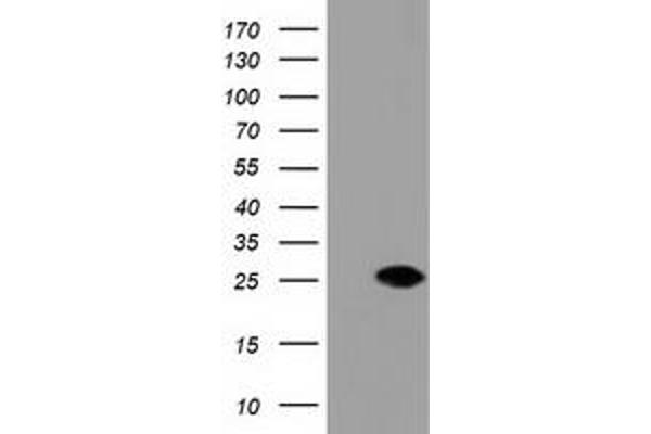 DUPD1 anticorps