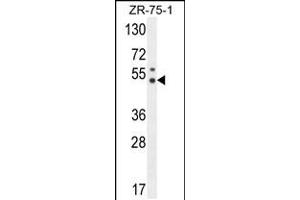 Western blot analysis in ZR-75-1 cell line lysates (35ug/lane). (PUS3 anticorps  (N-Term))