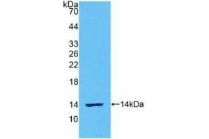 Detection of Recombinant IL8, Ovine using Polyclonal Antibody to Interleukin 8 (IL8) (IL-8 anticorps  (AA 23-101))