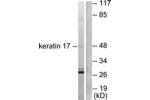 Western blot analysis of extracts from HuvEc cells, using Keratin 17 Antibody. (KRT17 anticorps  (AA 381-430))