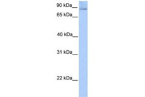 WB Suggested Anti-SLITRK1 Antibody Titration:  0. (SLITRK1 anticorps  (N-Term))