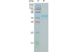 CCR5 Protein (AA 1-30) (Fc Tag)