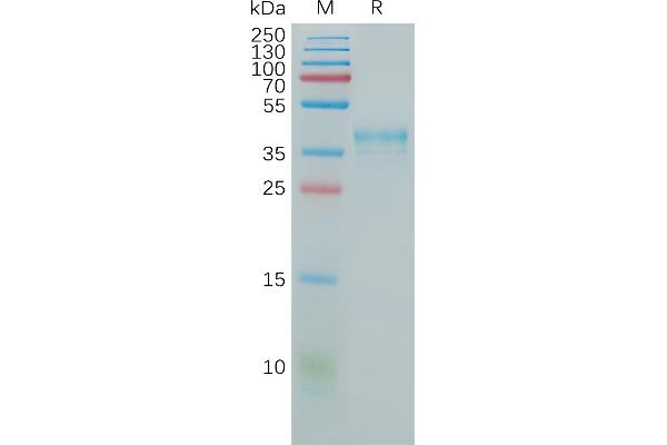 CCR5 Protein (AA 1-30) (Fc Tag)
